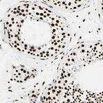 FUS Antibody in Immunohistochemistry (IHC)