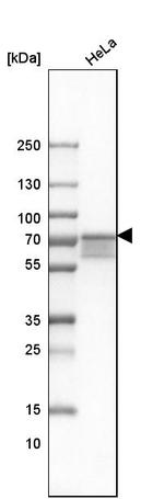 FUS Antibody in Western Blot (WB)