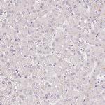 v-Myb Antibody in Immunohistochemistry (Paraffin) (IHC (P))