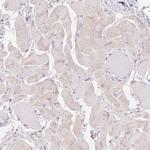 v-Myb Antibody in Immunohistochemistry (Paraffin) (IHC (P))