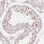 v-Myb Antibody in Immunohistochemistry (Paraffin) (IHC (P))