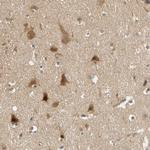 PDDC1 Antibody in Immunohistochemistry (Paraffin) (IHC (P))