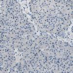 Neurofascin Antibody in Immunohistochemistry (IHC)