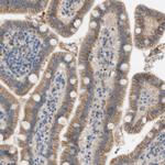 FDFT1 Antibody in Immunohistochemistry (Paraffin) (IHC (P))