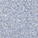 FDFT1 Antibody in Immunohistochemistry (Paraffin) (IHC (P))