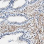 FDFT1 Antibody in Immunohistochemistry (Paraffin) (IHC (P))