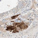 FDFT1 Antibody in Immunohistochemistry (Paraffin) (IHC (P))