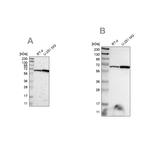 ME2 Antibody in Western Blot (WB)