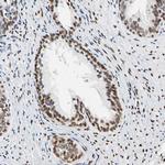 NFIA Antibody in Immunohistochemistry (IHC)