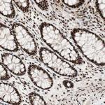 HEXIM1 Antibody in Immunohistochemistry (Paraffin) (IHC (P))