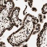 HEXIM1 Antibody in Immunohistochemistry (IHC)