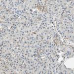 ENDOD1 Antibody in Immunohistochemistry (IHC)