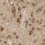 ENDOD1 Antibody in Immunohistochemistry (IHC)