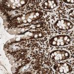 C17orf85 Antibody in Immunohistochemistry (Paraffin) (IHC (P))