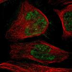 C17orf85 Antibody in Immunocytochemistry (ICC/IF)