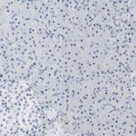 B4GALNT1 Antibody in Immunohistochemistry (Paraffin) (IHC (P))