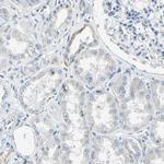 AATK Antibody in Immunohistochemistry (IHC)