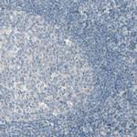 CYP2E1 Antibody in Immunohistochemistry (IHC)