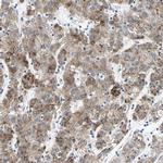 CYP2E1 Antibody in Immunohistochemistry (IHC)