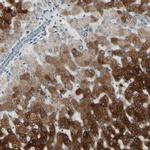 CYP2E1 Antibody in Immunohistochemistry (IHC)