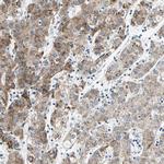 CYP2E1 Antibody in Immunohistochemistry (IHC)