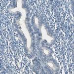 CYP2E1 Antibody in Immunohistochemistry (IHC)