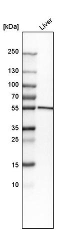 CYP2E1 Antibody in Western Blot (WB)