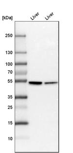 CYP2E1 Antibody in Western Blot (WB)