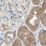 LHPP Antibody in Immunohistochemistry (IHC)