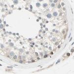 LHPP Antibody in Immunohistochemistry (IHC)