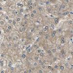 LHPP Antibody in Immunohistochemistry (IHC)