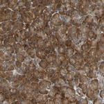 VAPA Antibody in Immunohistochemistry (Paraffin) (IHC (P))