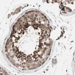 OAZ1 Antibody in Immunohistochemistry (Paraffin) (IHC (P))