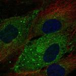 CD93 Antibody in Immunocytochemistry (ICC/IF)