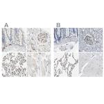 CD93 Antibody in Immunohistochemistry (IHC)