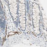 CD93 Antibody in Immunohistochemistry (IHC)