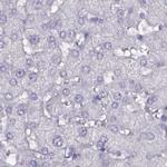 DPEP1 Antibody in Immunohistochemistry (IHC)