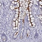 DPEP1 Antibody in Immunohistochemistry (IHC)