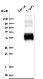 DPEP1 Antibody in Western Blot (WB)