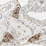 NDFIP1 Antibody in Immunohistochemistry (Paraffin) (IHC (P))