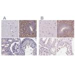 SFRP4 Antibody in Immunohistochemistry (IHC)