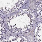 SFRP4 Antibody in Immunohistochemistry (IHC)