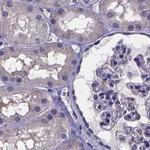 SFRP4 Antibody in Immunohistochemistry (IHC)