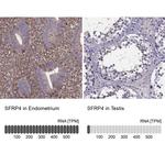 SFRP4 Antibody