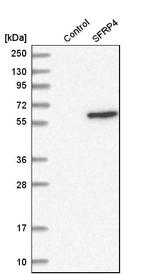 SFRP4 Antibody in Western Blot (WB)