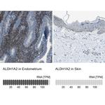 ALDH1A2 Antibody in Immunohistochemistry (IHC)