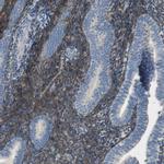 ALDH1A2 Antibody in Immunohistochemistry (IHC)