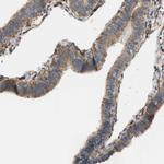 ALDH1A2 Antibody in Immunohistochemistry (IHC)