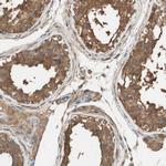 ALDH1A2 Antibody in Immunohistochemistry (IHC)