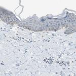 ALDH1A2 Antibody in Immunohistochemistry (IHC)